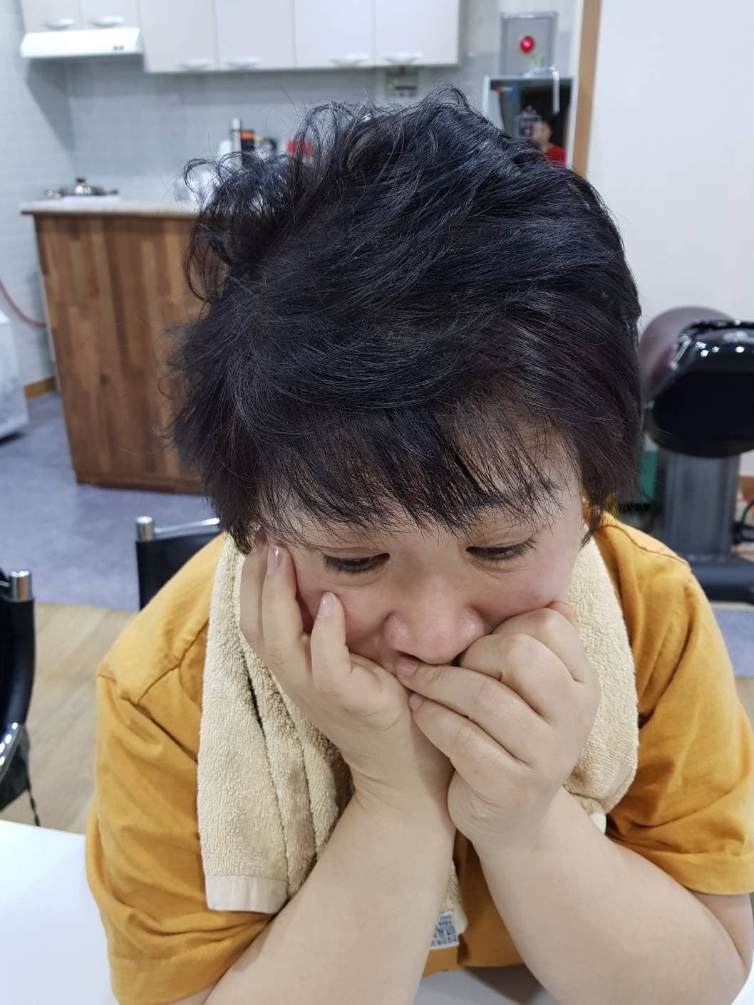 薄毛改善(女性) 施術後